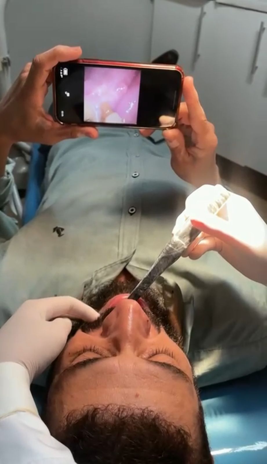 intraoral camera